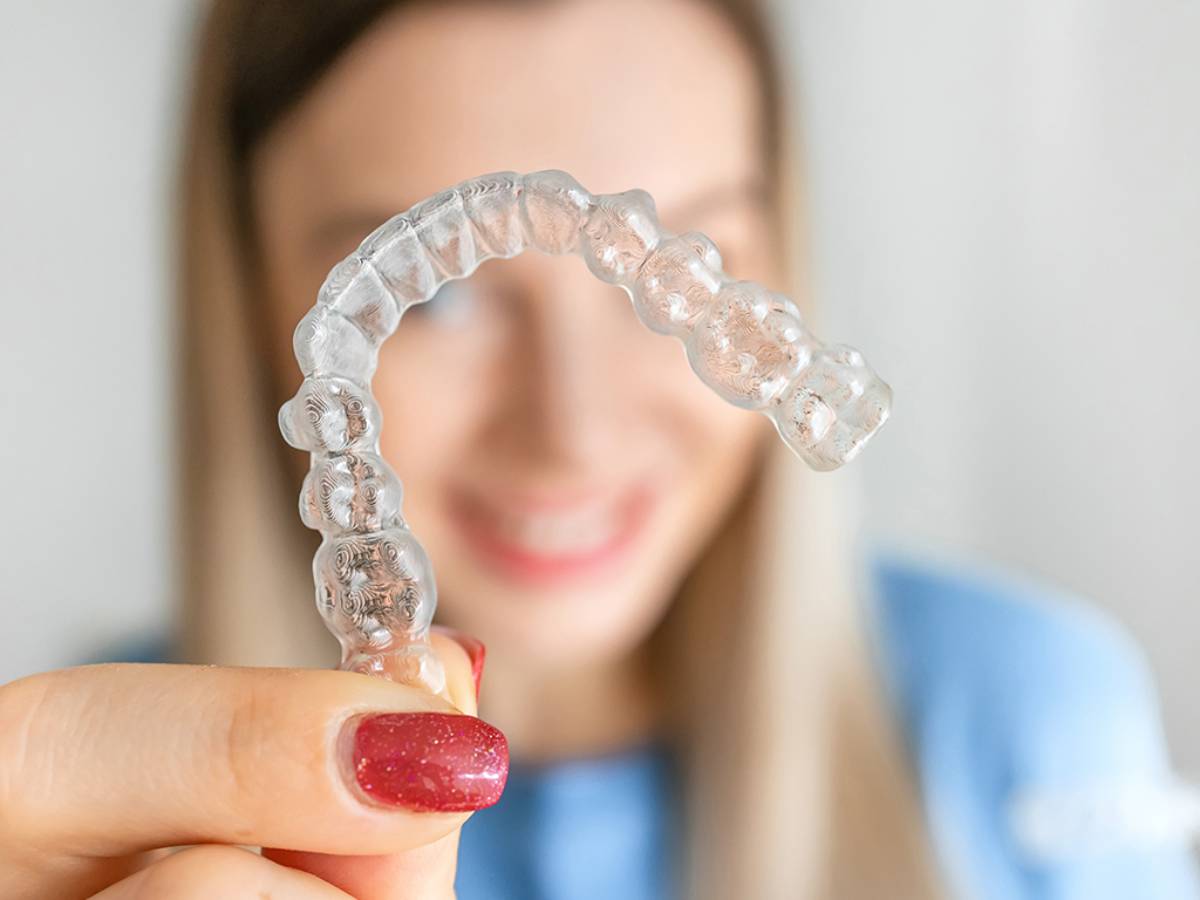 Clear Aligners Therapy Explained: How They Straighten Teeth